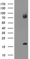 Cytochrome P450 2A6 (CYP2A6) antibody