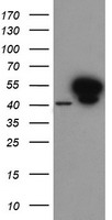 Cytochrome P450 2C9 (CYP2C9) antibody