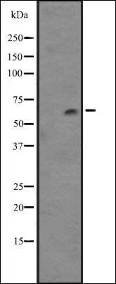 Cytochrome P450 4F12 antibody