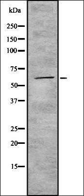 Cytochrome P450 4F22 antibody