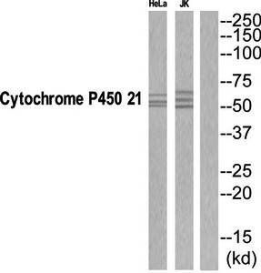 Cytochrome P450 21 antibody
