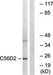 C56D2 Antibody