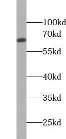 Cytokeratin 1-specific antibody