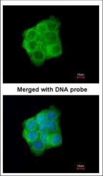 Cytokeratin 13 antibody