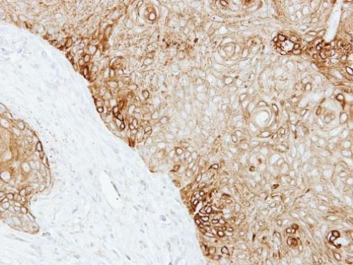 Cytokeratin 13 Rabbit Polyclonal Antibody