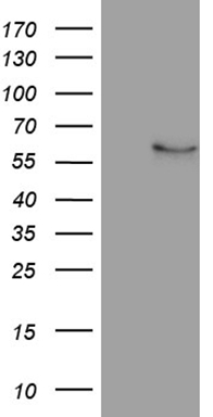 Cytokeratin 16 (KRT16) antibody