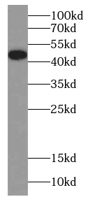 Cytokeratin 17-Specific antibody