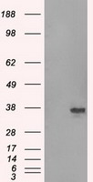 Cytokeratin 18 (KRT18) antibody