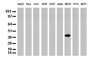 Cytokeratin 19 (KRT19) antibody