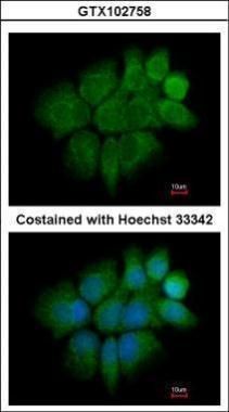 Cytokeratin 2 antibody [N2C2], Internal