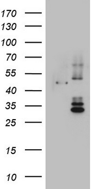 Cytokeratin 20 (KRT20) antibody