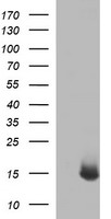 Cytokeratin 20 (KRT20) antibody