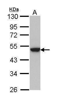 Cytokeratin 31 Rabbit Polyclonal Antibody