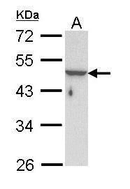 Cytokeratin 31 Rabbit Polyclonal Antibody