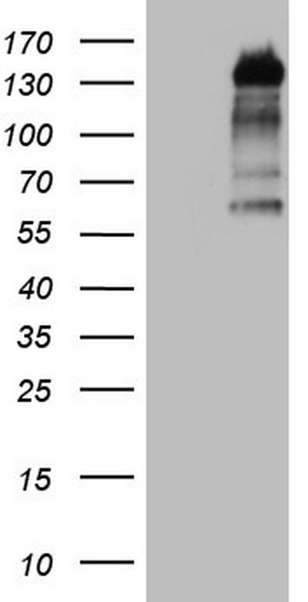 Cytokeratin 5 (KRT5) antibody