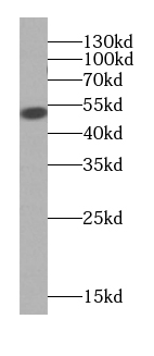 Cytokeratin 7-specific antibody