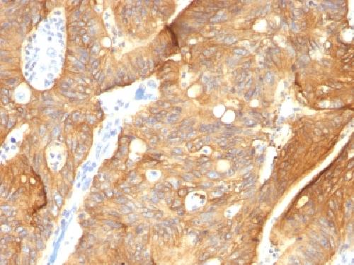 KRT8 Antibody