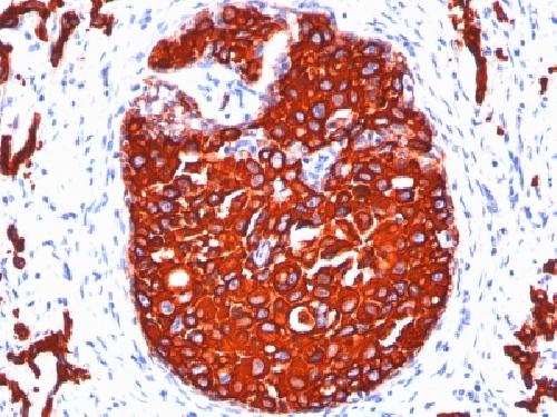 Cytokeratin, pan (Epithelial Marker) Antibody