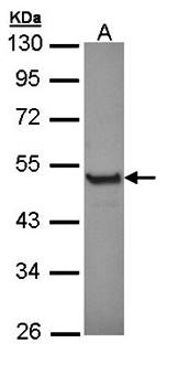 Cytokeratin 13 antibody