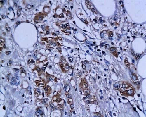 CK14+17+42+10 Rabbit Polyclonal Antibody