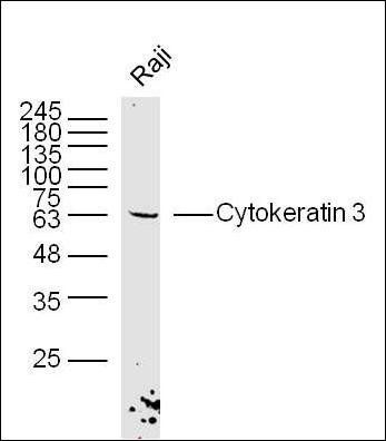Cytokeratin 3 antibody