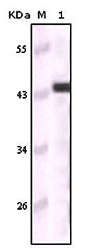Cytokeratin 5 Antibody