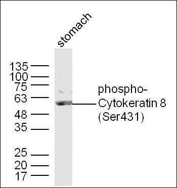 Cytokeratin 8 (Phospho-Ser431) antibody