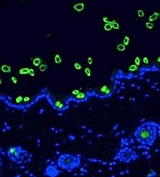Hair Cortex Cytokeratin/K40 Monoclonal Antibody [AE13]