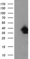 Cytoplasmic dynein 1 light intermediate chain 1 (DYNC1LI1) antibody