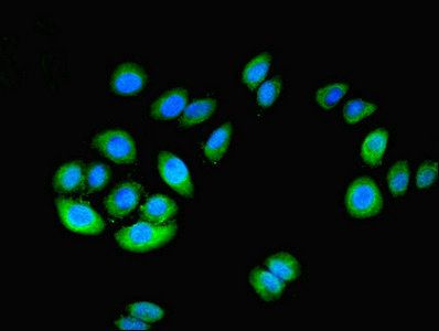 Cytosolic 5'-nucleotidase 1A antibody