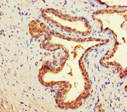 Cytosolic non-specific dipeptidase antibody