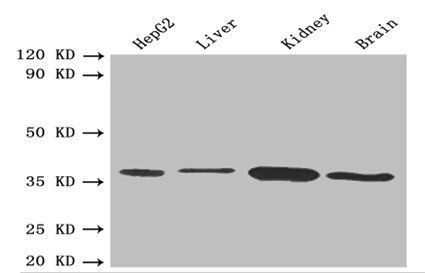 D-beta-hydroxybutyrate dehydrogenase, mitochondrial antibody