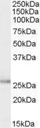 TPD52L1 antibody