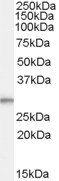 Goat anti-TPD52L2 / D54 Antibody