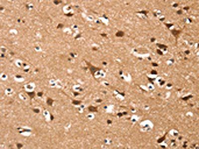 DAAM1 Antibody