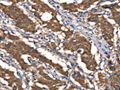 DAAM1 Antibody