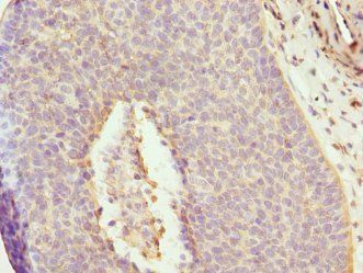 DAAM2 Antibody