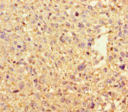 DAAM2 Antibody