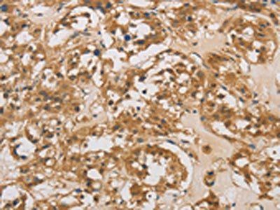 DAB2 Antibody