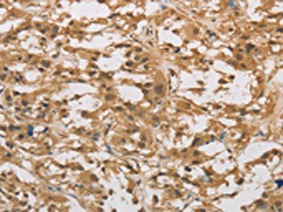 DAB2 Antibody