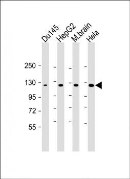 DAB2IP antibody