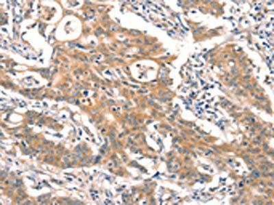 DAB2IP Antibody