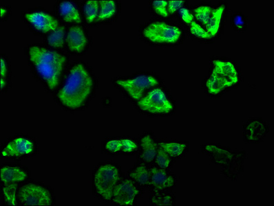 DAB2IP antibody