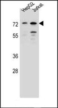 DACH2 antibody