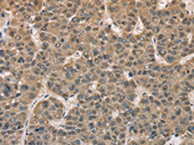 DACH2 antibody