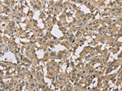 DACH2 Antibody