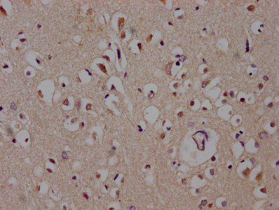 DACT1 Antibody