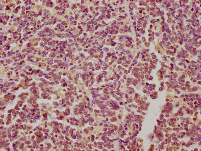 DAG1 antibody