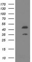 DAP Kinase 2 (DAPK2) antibody