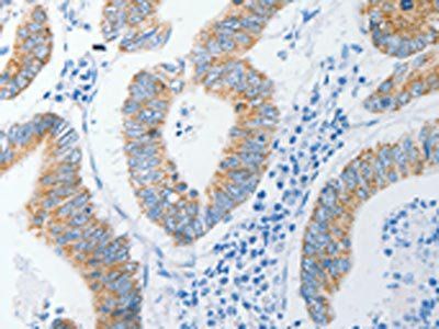 DAP3 Antibody